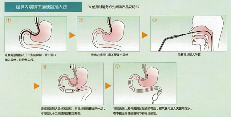 示意图